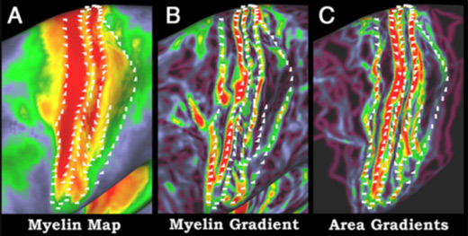 /news/2011/08/blog-myelin-map.jpg