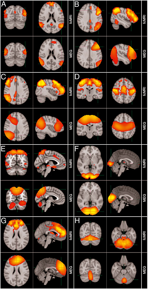 Electrophysiological Origins Of Connectivity Characterizing Resting State Networks With Meg 2963